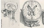 Leonardo da Vinci (1452 - 1519), desenhou de modo certo, pela primeira vez, os ventrculos do crebro, a partir de 1504. <br><br> Palavras-chave: Leonardo da Vinci, crebro, ventrculo, cincia, esttica  